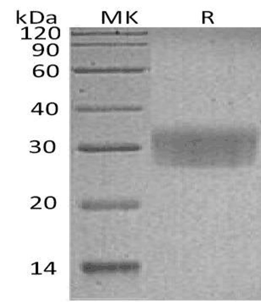 Human CD7/GP40 Recombinant Protein (RPES0117)