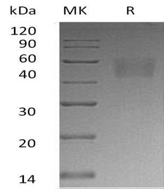 Human Nectin-3/PVRL3 Recombinant Protein (RPES0119)