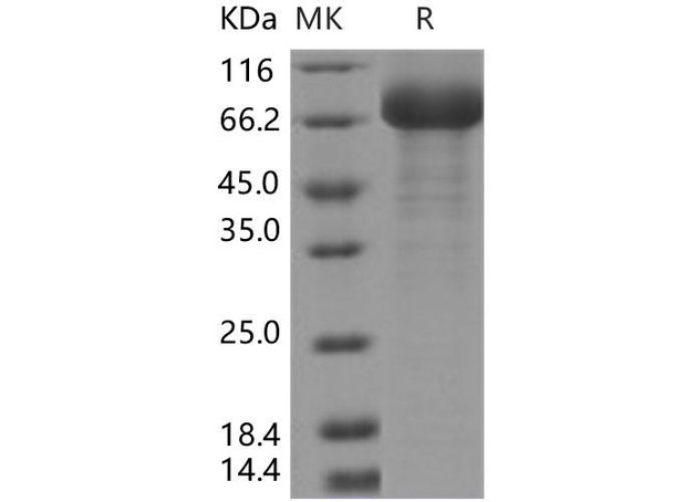 Human SIGLEC6/CD327 Recombinant Protein (RPES0136)