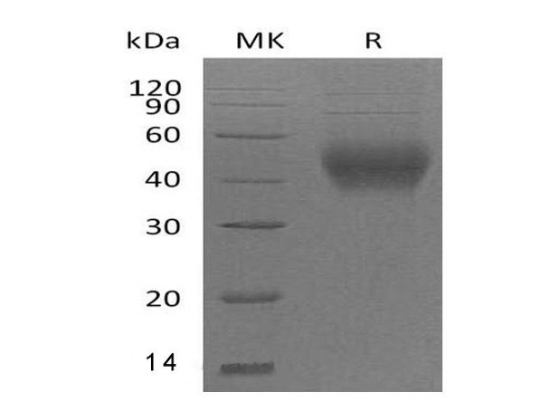 Mouse CD48 Recombinant Protein (RPES0146)