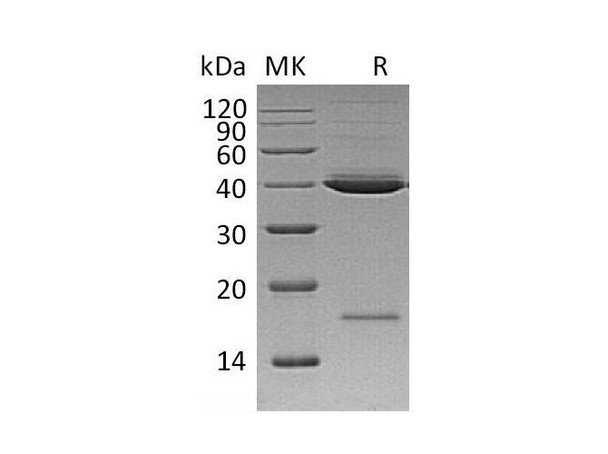 Human Spondin 2/SPON2 Recombinant Protein (RPES0162)