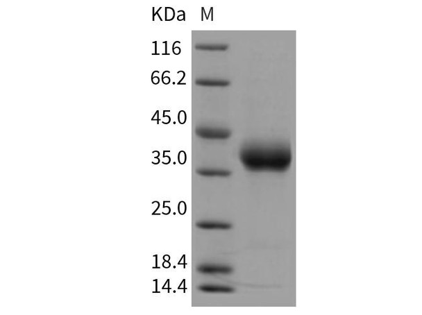 Rat PRLR/Prolactin Receptor Recombinant Protein (RPES0163)