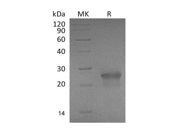 Mouse XEDAR/EDA2R Recombinant Protein (RPES0167)
