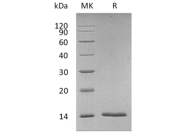 Human S100A7/PSOR1 Recombinant Protein (RPES0169)