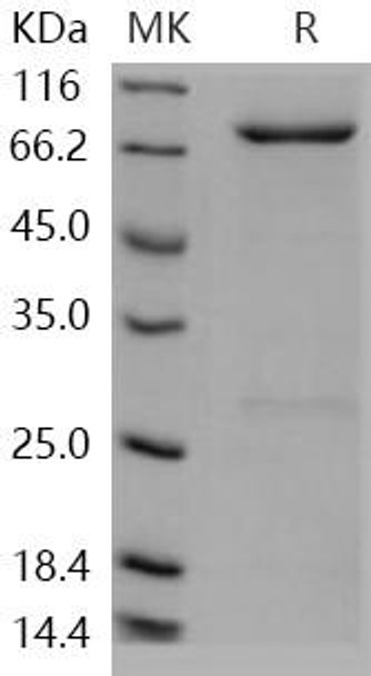 Human PDE9A Recombinant Protein (RPES0173)