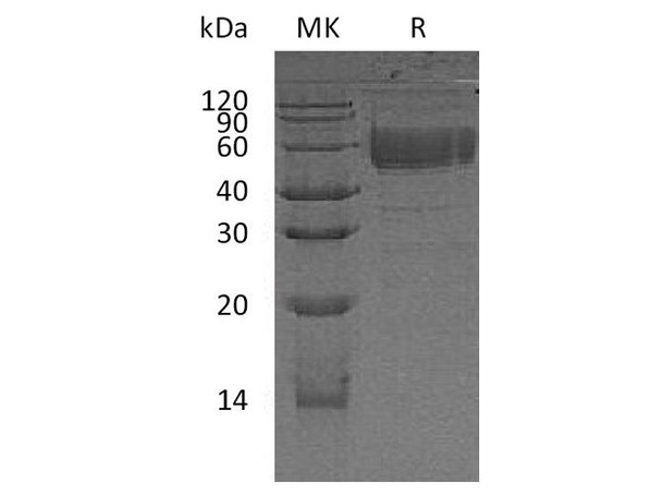 Human CD83/HB15 Recombinant Protein (RPES0180)
