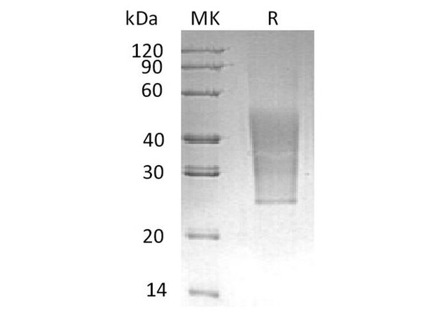 Human CD99L2 Recombinant Protein (RPES0200)