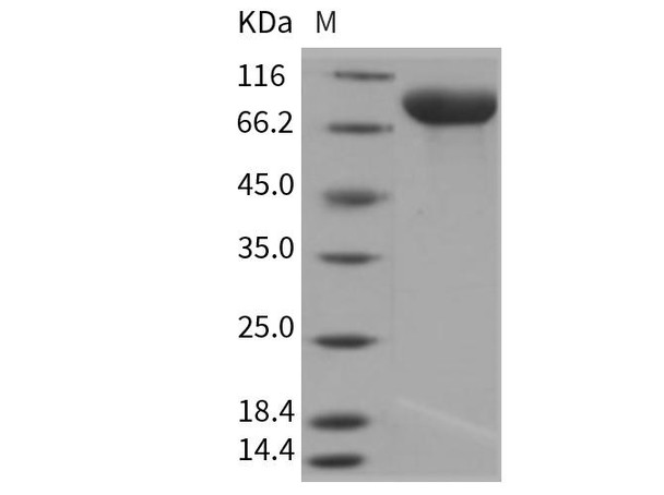 Rat IL6ST/CD130 Recombinant Protein (RPES0204)