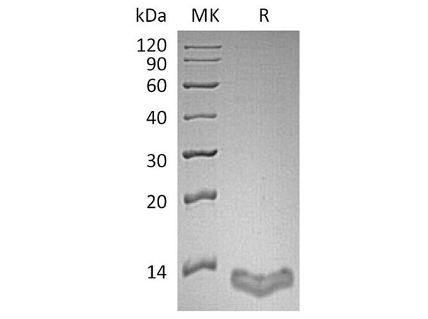 Human S100A16/S100F Recombinant Protein (RPES0210)