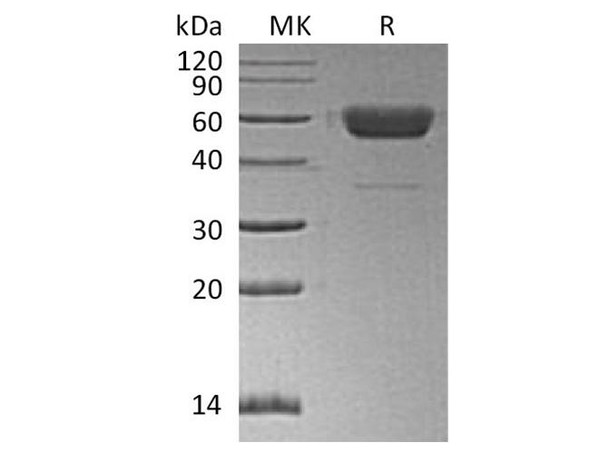 Human/Mouse/Rat Irisin/FNDC5 Recombinant Protein (RPES0211)