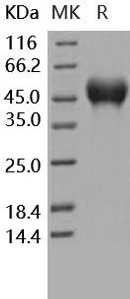 Human CD16a/FCGR3A Recombinant Protein (RPES0229)