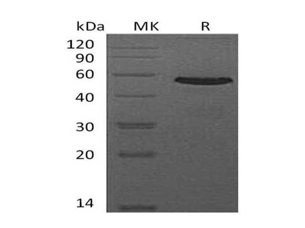 Mouse CD40/TNFRSF5 Recombinant Protein (RPES0245)