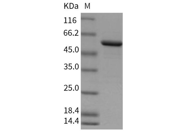 Rat Galectin-8/LGALS8 Recombinant Protein (RPES0252)