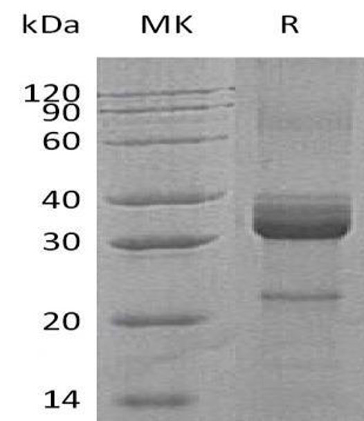 Human Pre-Haptoglobin-2/Zonulin Recombinant Protein (RPES0258)