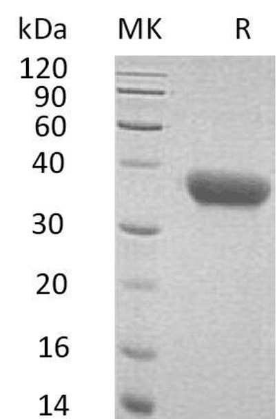 Mouse CXCL16 Recombinant Protein (RPES0262)