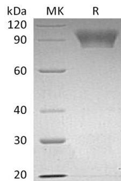 Human NLGN4X Recombinant Protein (RPES0279)