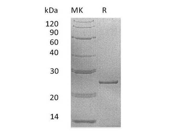 Human Prolactin/PRL Recombinant Protein (RPES0285)