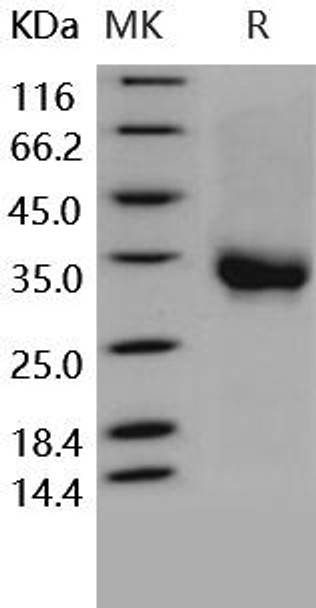 Human CD32a/FCGR2A Recombinant Protein (RPES0287)