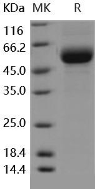 Human DDR2 Kinase/CD167b Recombinant Protein (RPES0290)