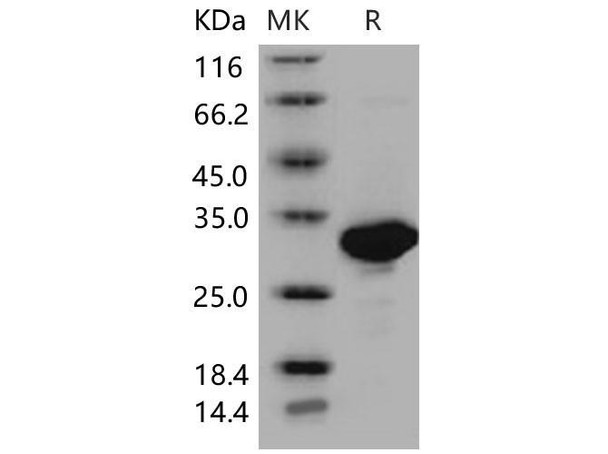 Mouse CA2 Recombinant Protein (RPES0292)