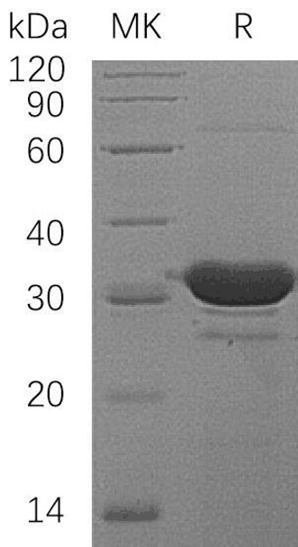 Human HDHD2 Recombinant Protein (RPES0297)
