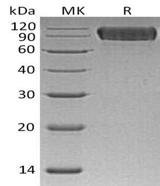 Human Neuroligin 1/NLGN1 Recombinant Protein (RPES0298)