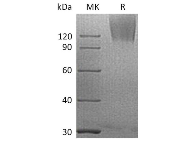 Human CEACAM5/CEA Recombinant Protein (RPES0316)