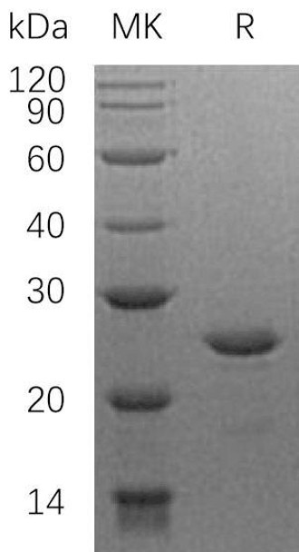 Human HSF2 Recombinant Protein (RPES0317)