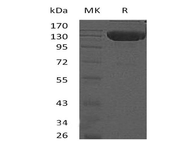 Mouse DR6/TNFRSF21 Recombinant Protein (RPES0323)