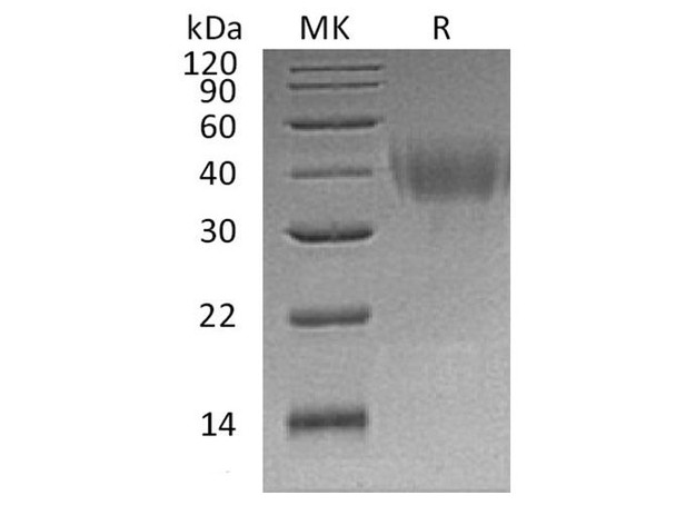 Human PD-L2/CD273 Recombinant Protein (RPES0324)