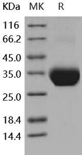 Human Layilin/LAYN Recombinant Protein (RPES0330)