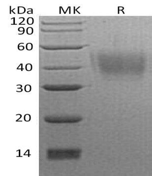 Human Neuroplastin/NPTN Recombinant Protein (RPES0338)