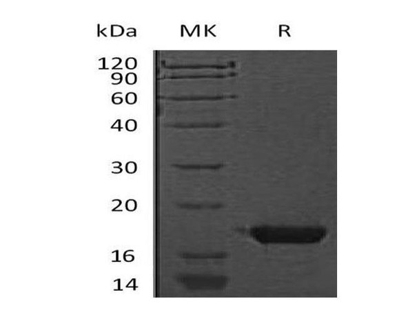 Mouse Cystatin 7/CST7 Recombinant Protein (RPES0341)