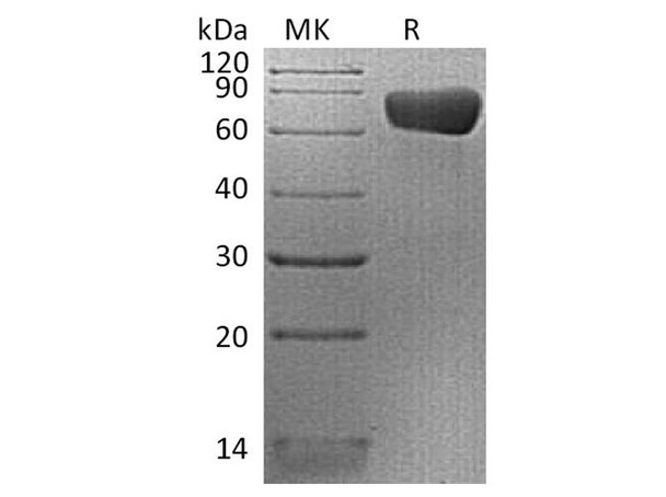Human PD-L2/CD273 Recombinant Protein (RPES0344)