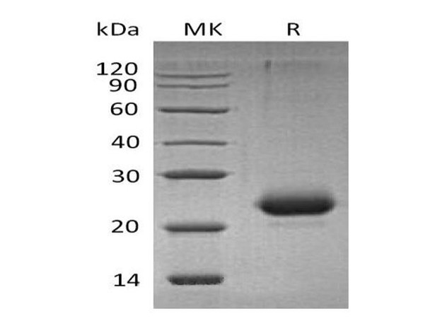 Mouse CD40/TNFRSF5 Recombinant Protein (RPES0345)