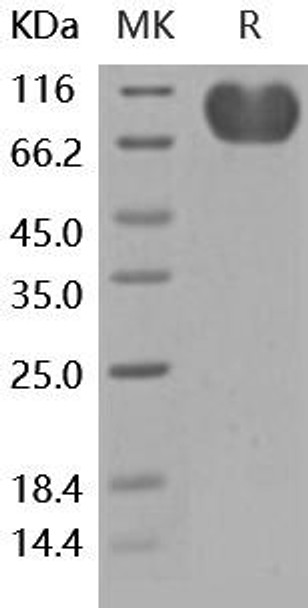 Human CD155/PVR Recombinant Protein (RPES0355)