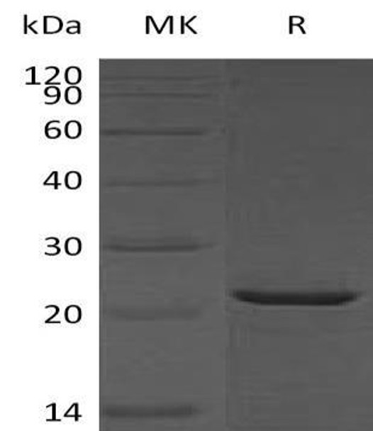Human HSPB2/MKBP Recombinant Protein (RPES0357)
