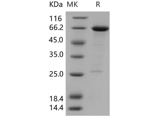 Human HDAC8/HDACL1 Recombinant Protein (RPES0367)