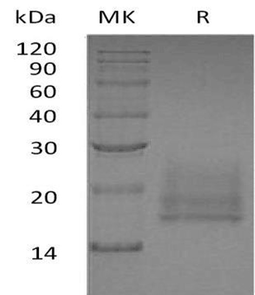 Human CEACAM8/CD66b Recombinant Protein (RPES0373)