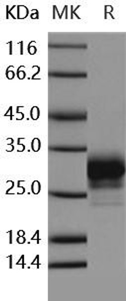 Human CD32a/FCGR2A Recombinant Protein (RPES0383)