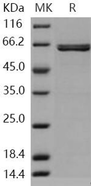 Human AIM2 Recombinant Protein (RPES0385)