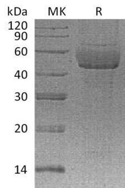 Human Syndecan/SDC1 Recombinant Protein (RPES0396)