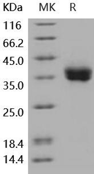 Human PD-L1/B7-H1/CD274 Recombinant Protein (RPES0412)