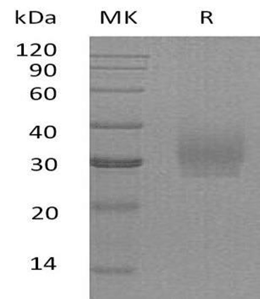 Human Syndecan-2/SDC2 Recombinant Protein (RPES0416)