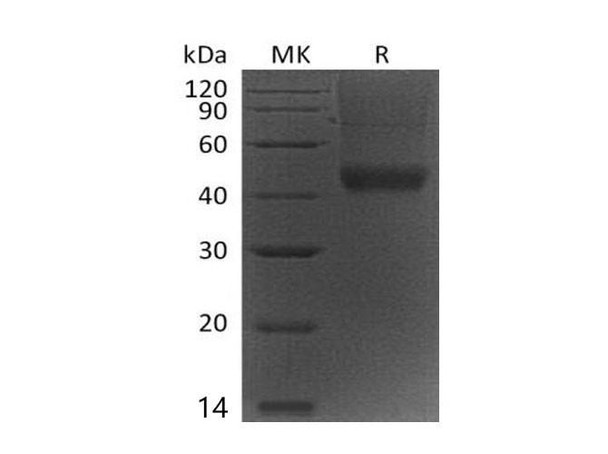 Mouse Decorin/DCN Recombinant Protein (RPES0418)