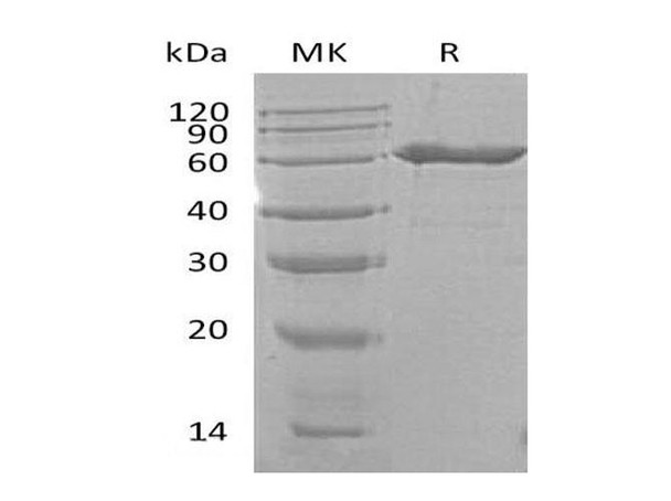 Mouse CD73/NT5E Recombinant Protein (RPES0420)