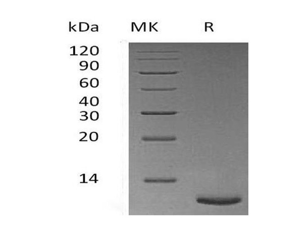 Mouse Trefoil Factor 3/TFF3 Recombinant Protein (RPES0422)