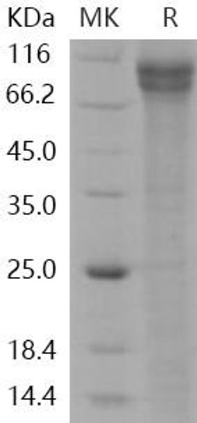 Human Jagged 1/JAG1 Recombinant Protein (RPES0425)
