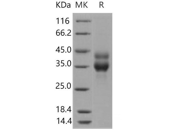 Mouse Cathepsin B/CTSB Recombinant Protein (RPES0430)