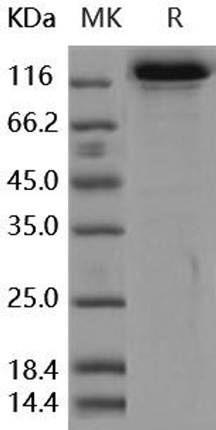 Human HER3/ErbB3 Recombinant Protein (RPES0446)